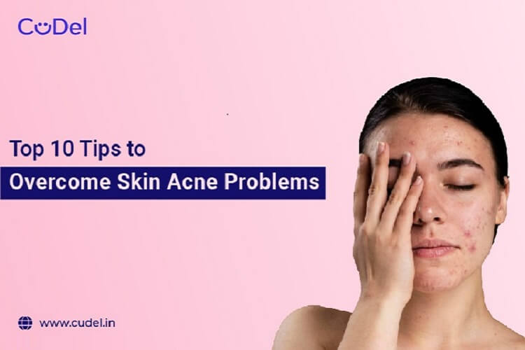 Top 10 Tips to Overcome Skin Acne Problems - CuDel