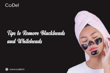 Tips to Remove Blackheads and Whiteheads - CuDel
