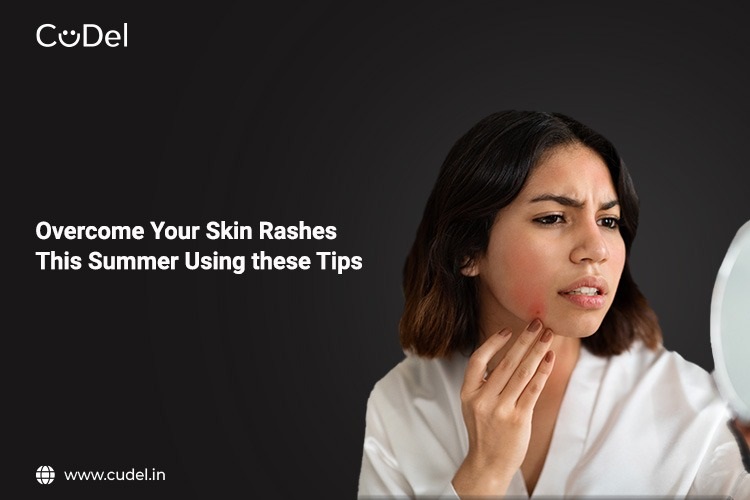CuDel-tips-to -overcome-skin-rashes